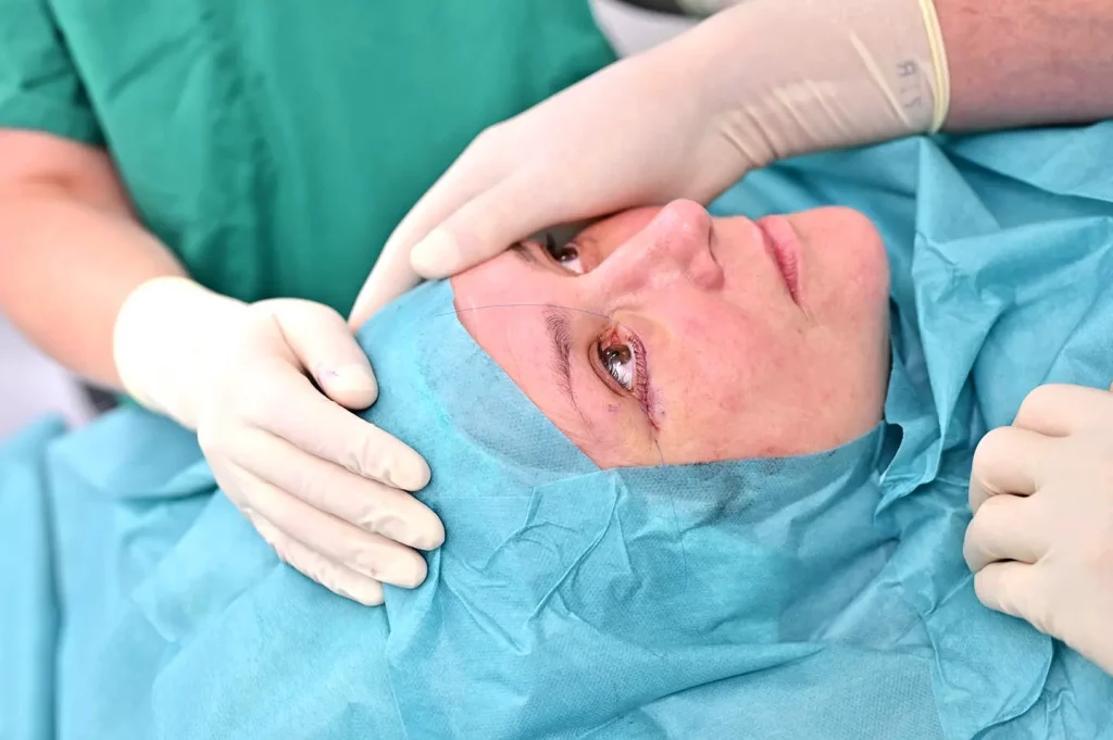 unterlidstraffung vorher-nachher